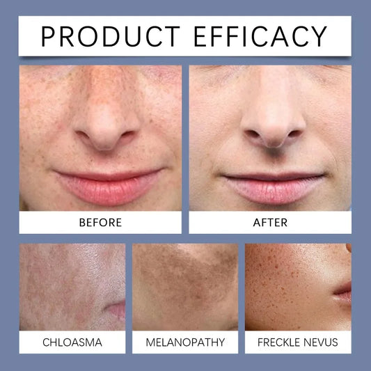 Face Dark Skin Brightening Cream. - Maison Novaire #