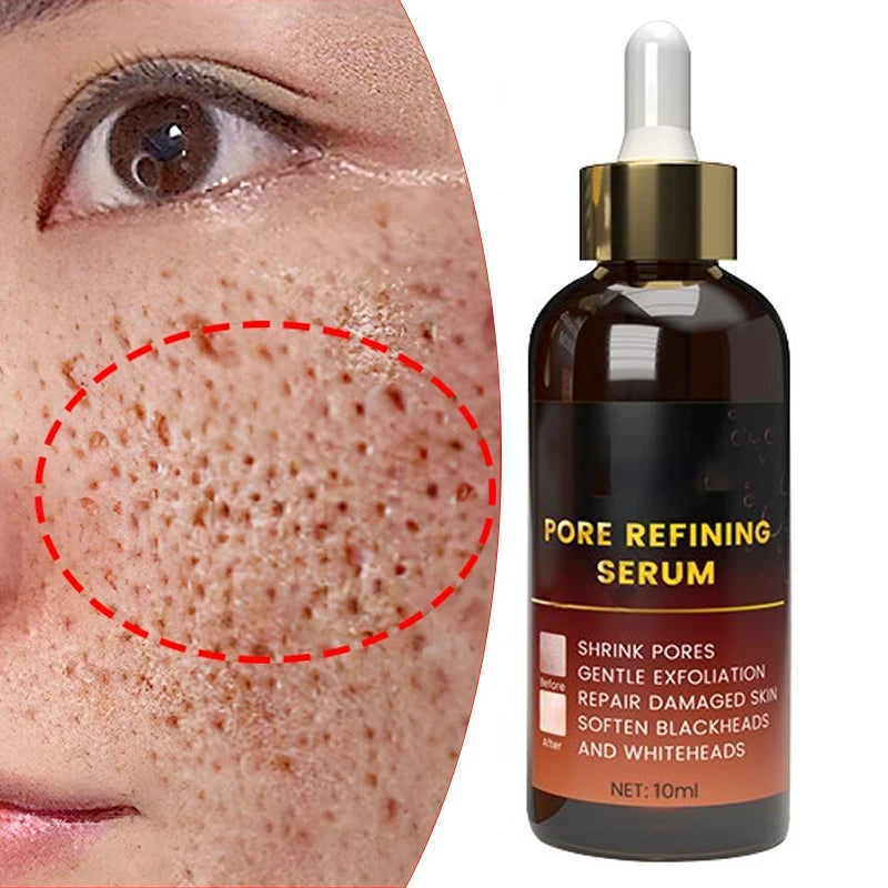 Acne Treatment Anti Aging Serum. - Maison Novaire #