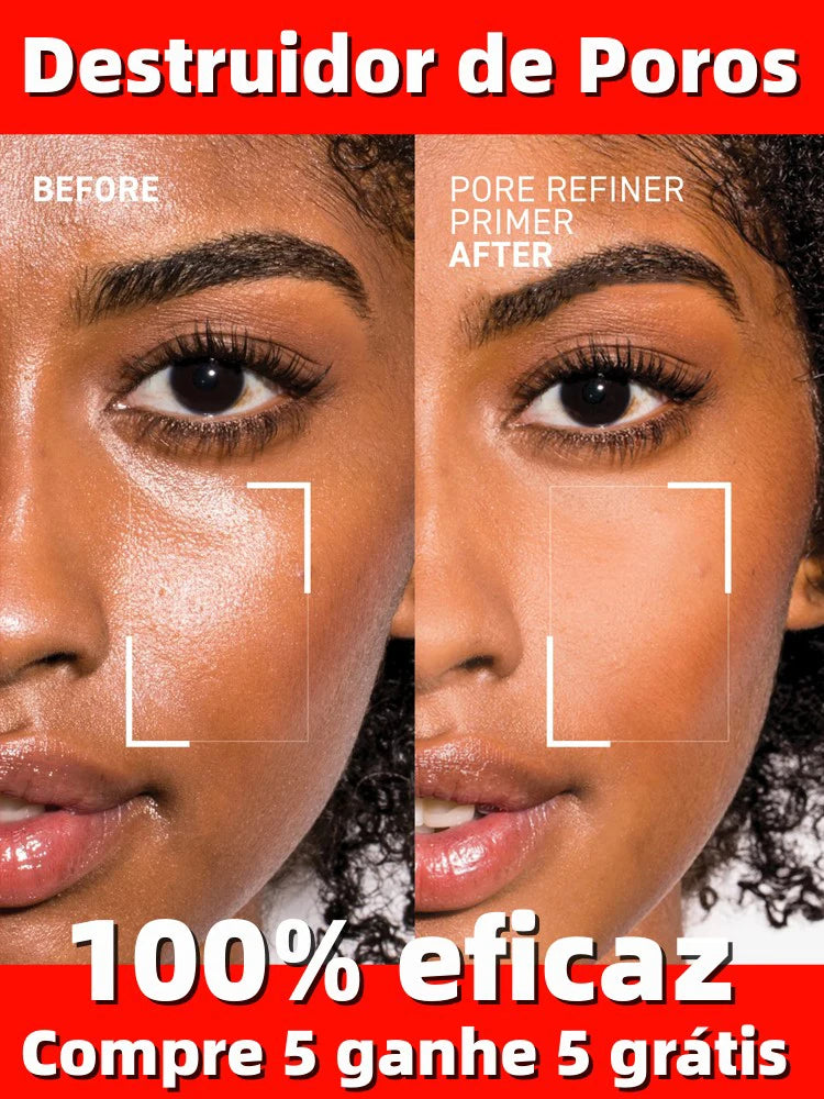 Acne Treatment Anti Aging Serum. - Maison Novaire #