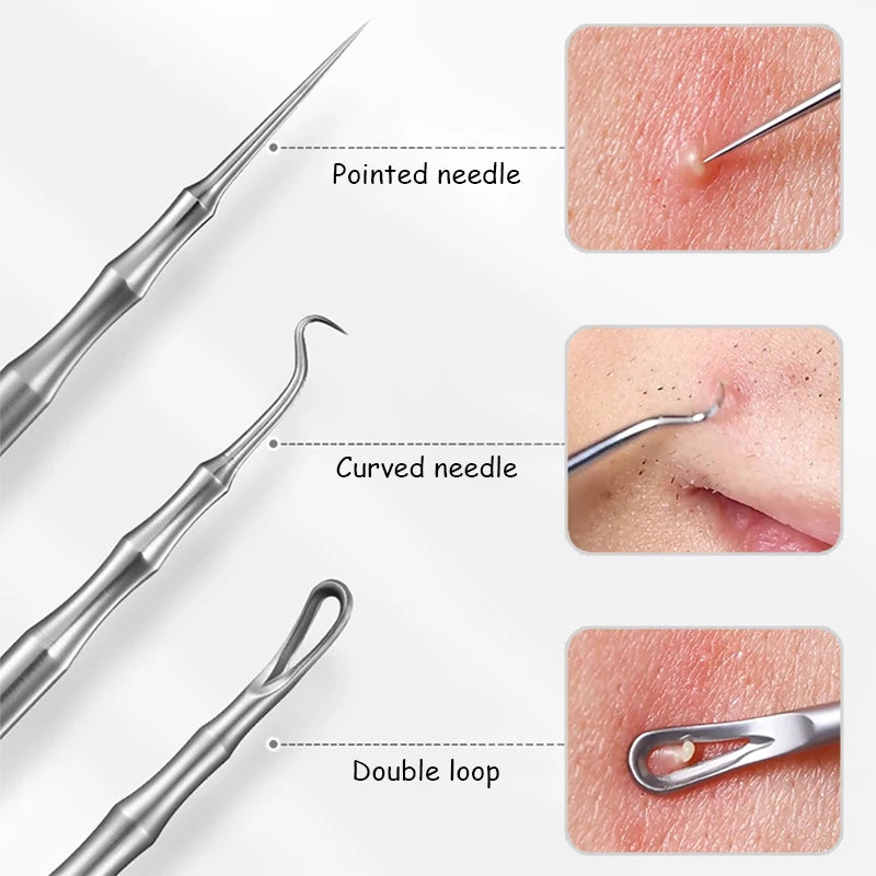 Acne and Pimples Removal Needles. - Maison Novaire #