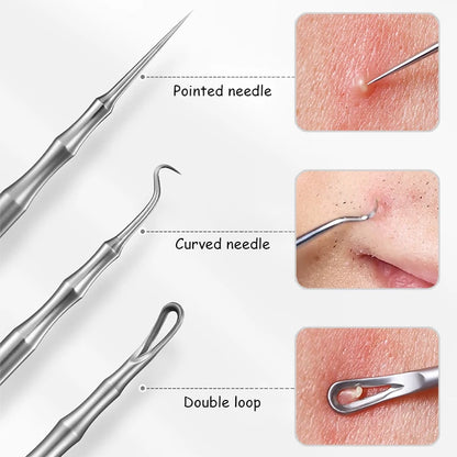 Acne and Pimples Removal Needles. - Maison Novaire #