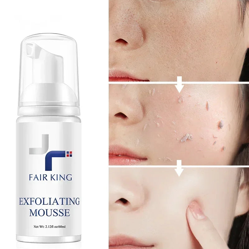 FAIR KING Exfoliating Mousse – Pore Minimizing & Oil Control Cleanser - Maison Novaire #