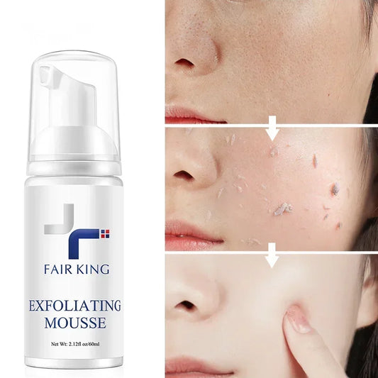 FAIR KING Exfoliating Mousse – Pore Minimizing & Oil Control Cleanser - Maison Novaire #