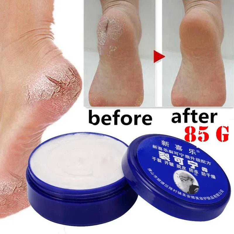 Feet and Hand Crack Removal Cream. - Maison Novaire #