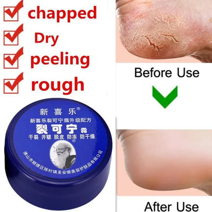 Feet and Hand Crack Removal Cream. - Maison Novaire #