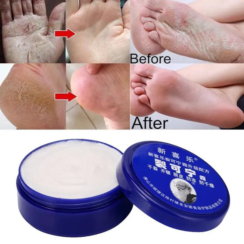 Feet and Hand Crack Removal Cream. - Maison Novaire #