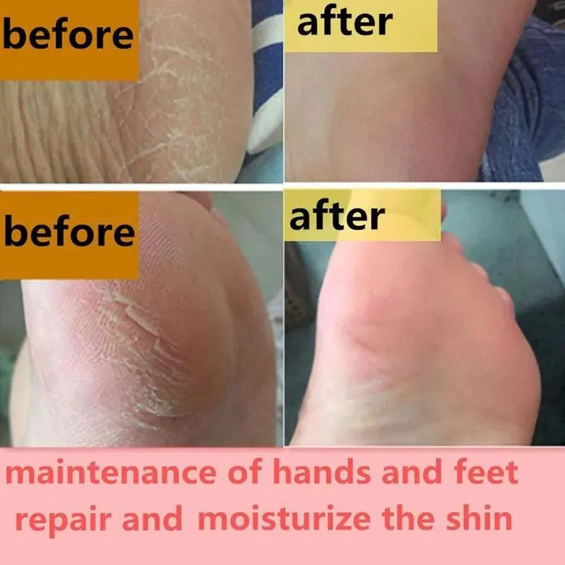 Feet and Hand Crack Removal Cream. - Maison Novaire #