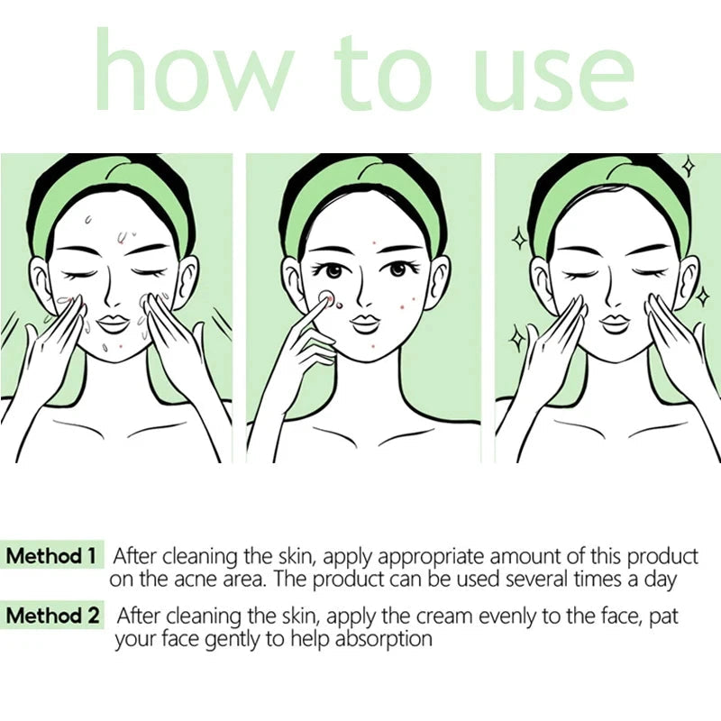 Herbal Acne Removal Face Cream. - Maison Novaire #