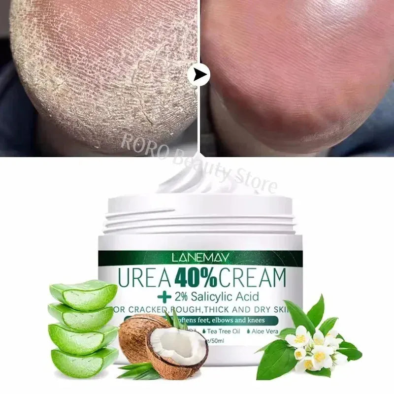 Herbal Anti Crack Foot Heel Cracking Repair Cream. - Maison Novaire #
