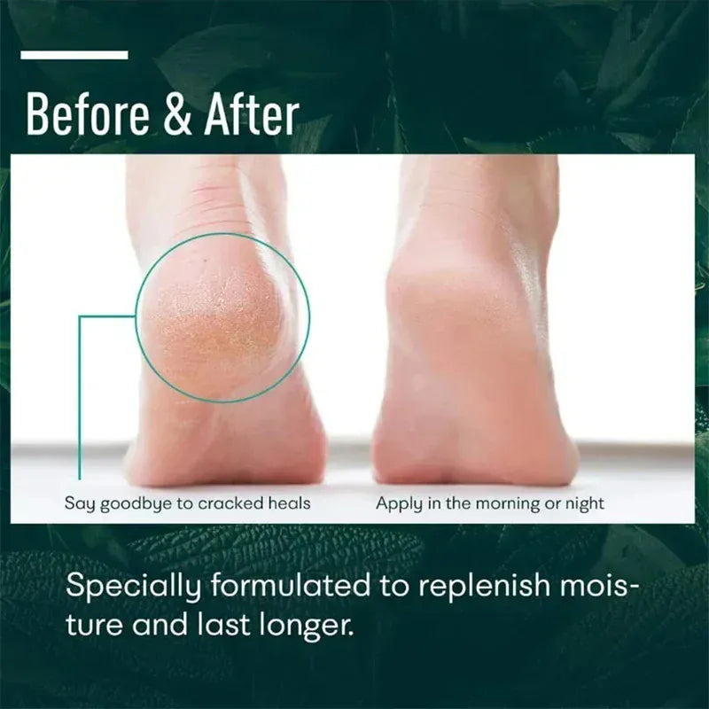 Herbal Anti Crack Foot Heel Cracking Repair Cream. - Maison Novaire #
