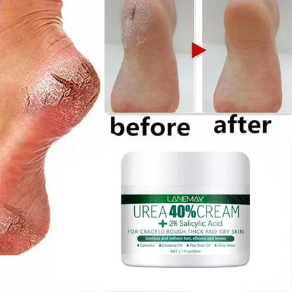 Herbal Anti Crack Foot Heel Cracking Repair Cream. - Maison Novaire #