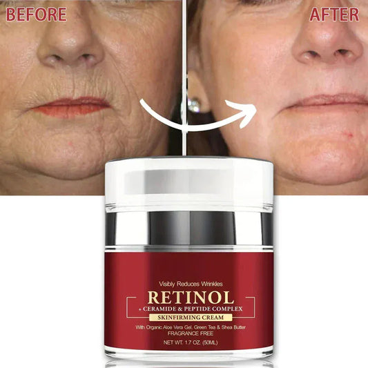 Instant Retinol Cream – Anti-Aging Firming & Lifting - Maison Novaire #