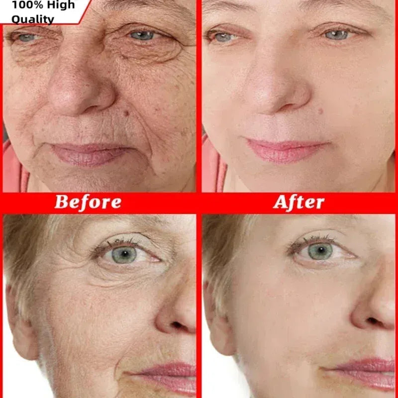 Japan Sakura Wrinkle Remover Face Serum. - Maison Novaire #