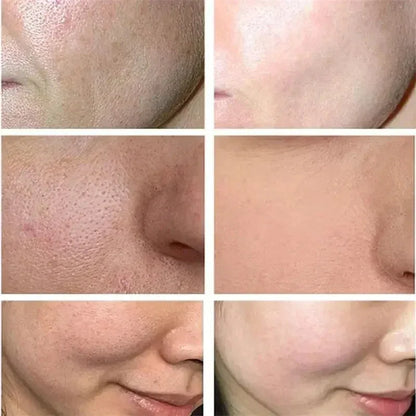 Japan Sakura Wrinkle Remover Face Serum. - Maison Novaire #