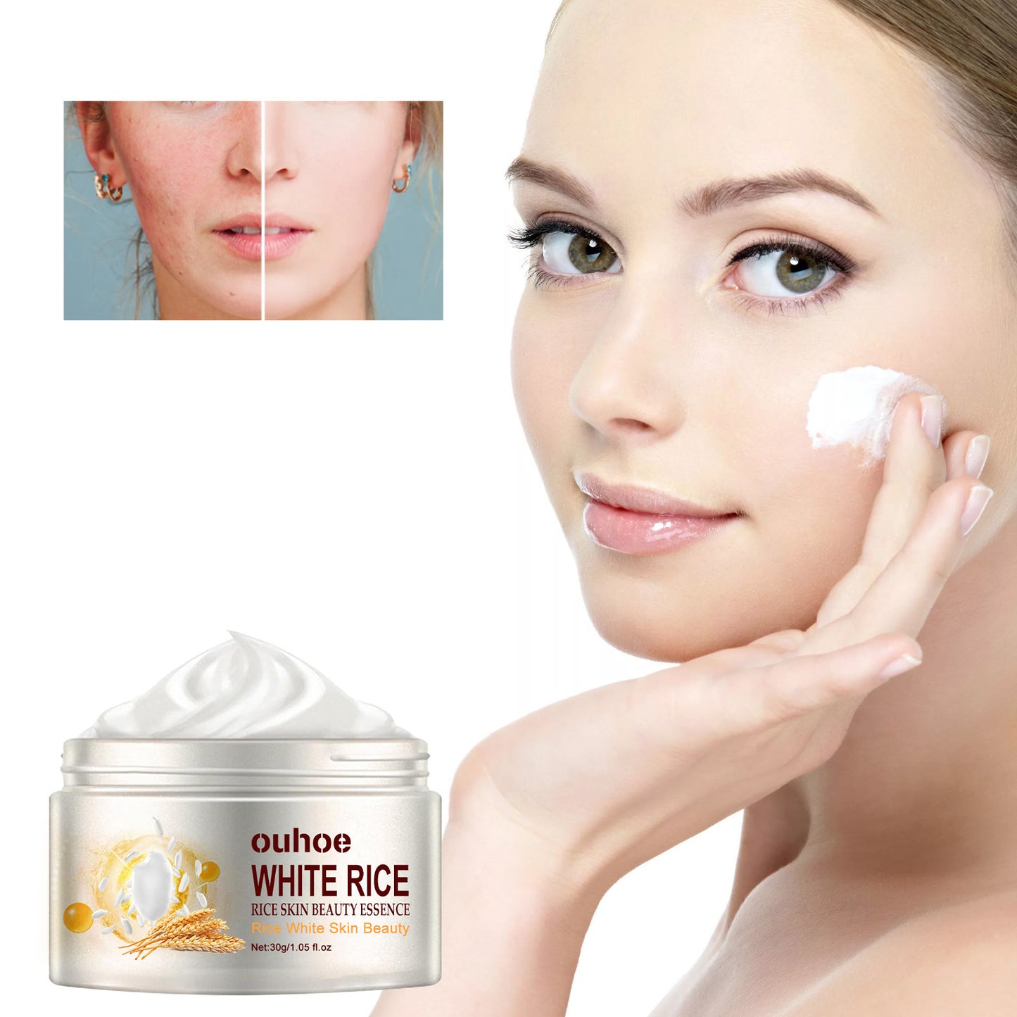 Rice Anti-Wrinkle Acne Moisturizer