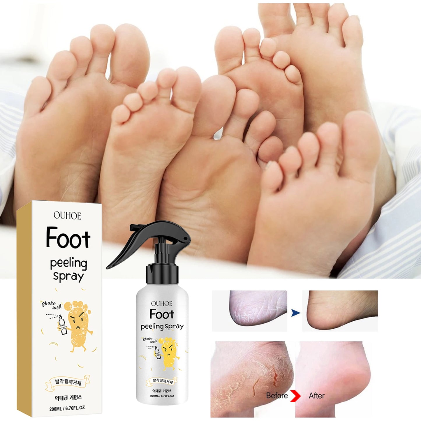 Ouhoe Foot Spray - BLAKESTORE-NG
