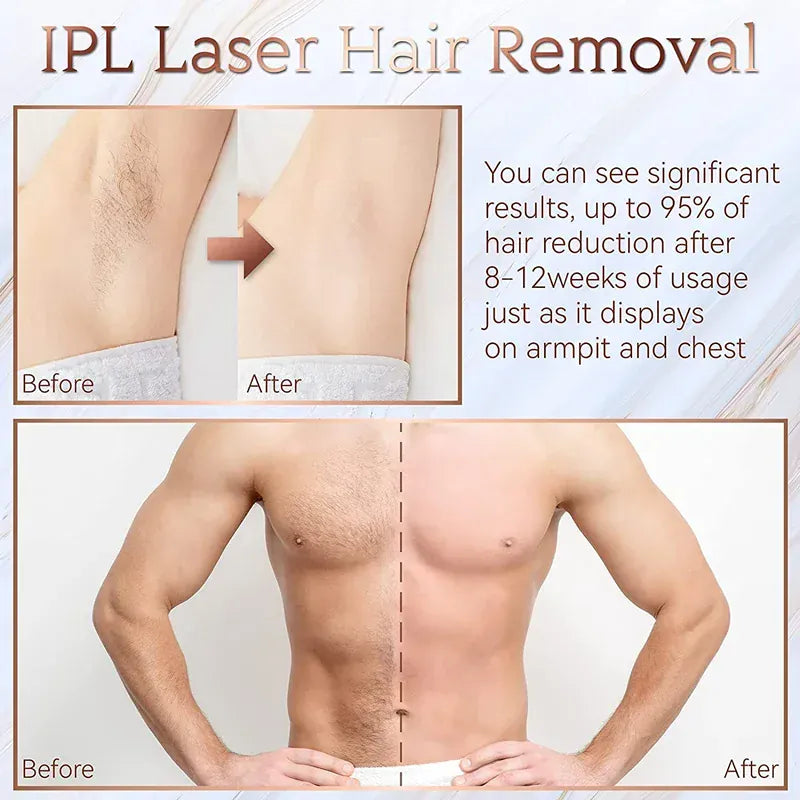 Painless Electric Epilator Laser Hair Removal. - Maison Novaire #