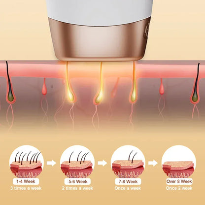 Painless Electric Epilator Laser Hair Removal. - Maison Novaire #