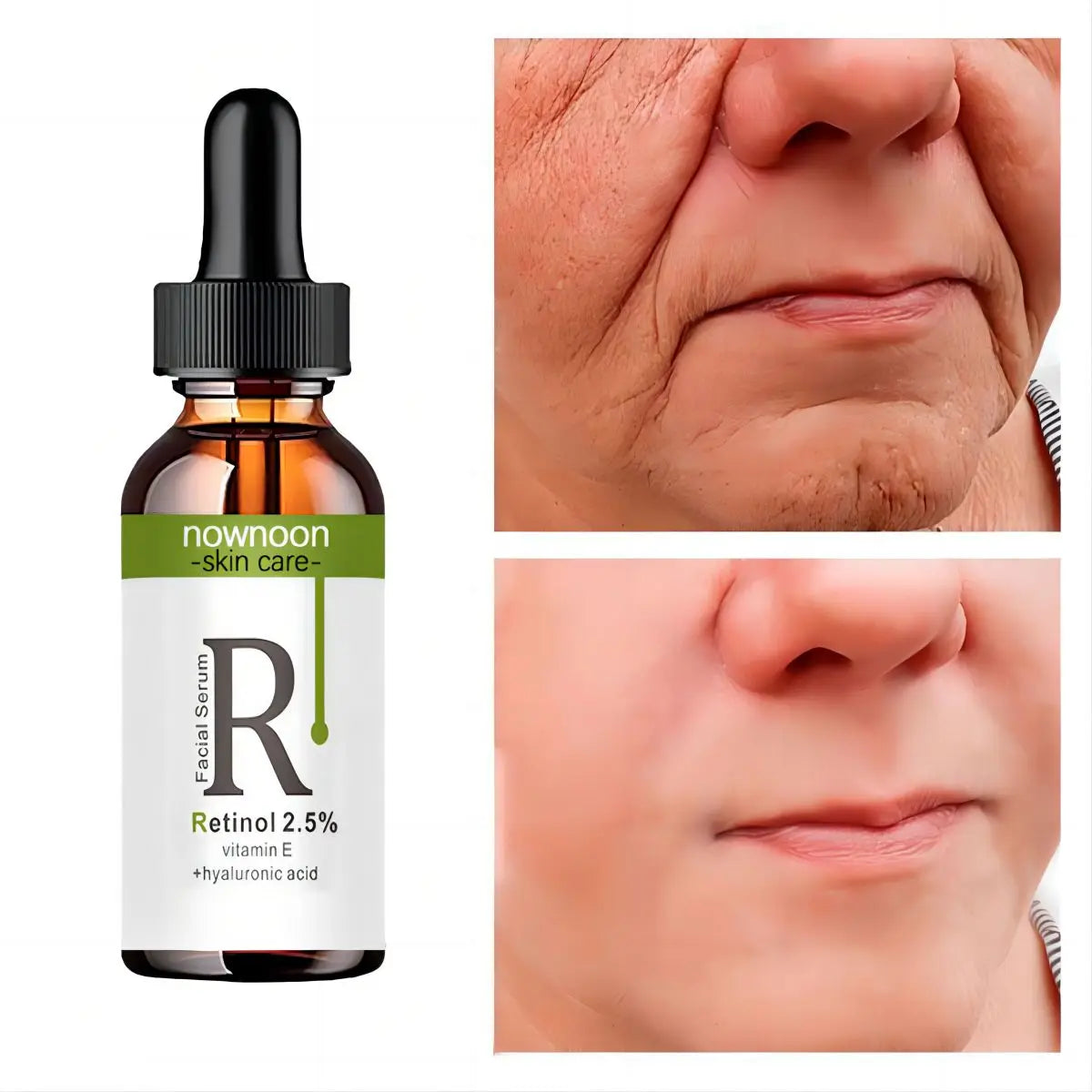 Retinol Anti Wrinkle Dark Spot Removal. - Maison Novaire #