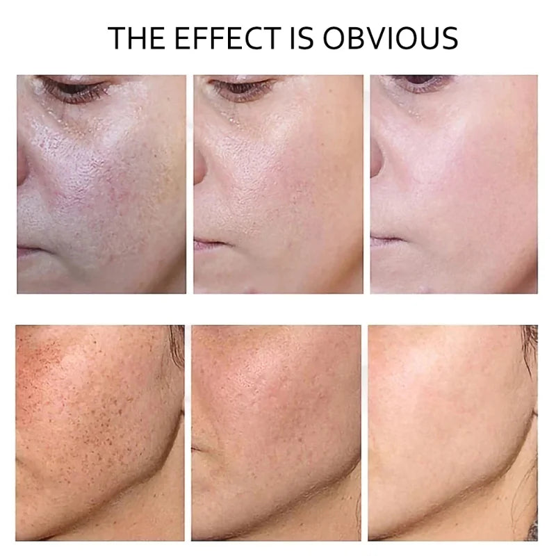 Retinol Anti Wrinkle Dark Spot Removal. - Maison Novaire #