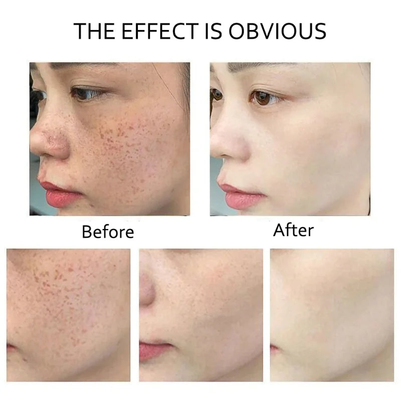 Retinol Anti Wrinkle Dark Spot Removal. - Maison Novaire #