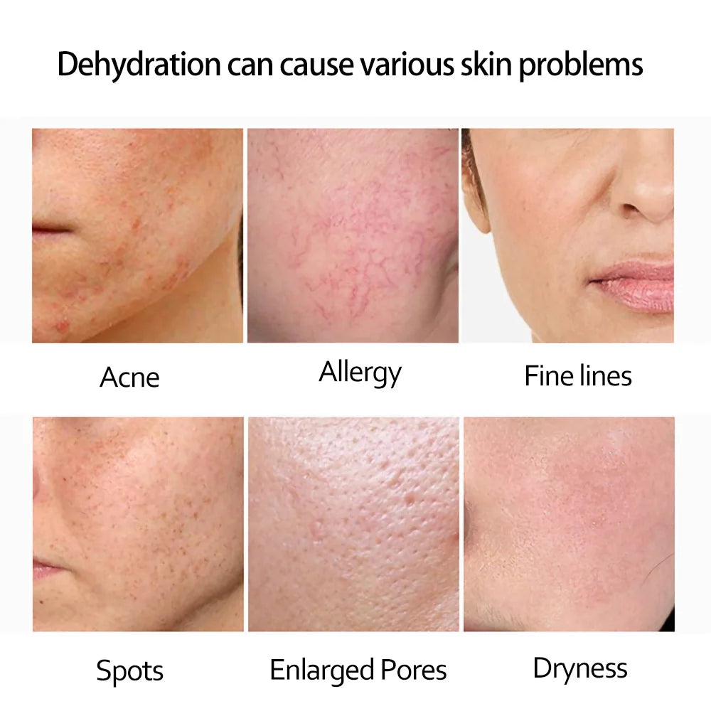 Retinol Anti Wrinkle Dark Spot Removal. - Maison Novaire #