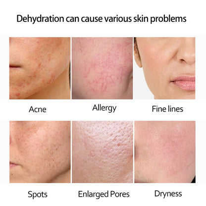 Retinol Anti Wrinkle Dark Spot Removal. - Maison Novaire #