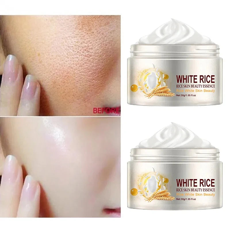 Rice Anti-Wrinkle Acne Moisturizer