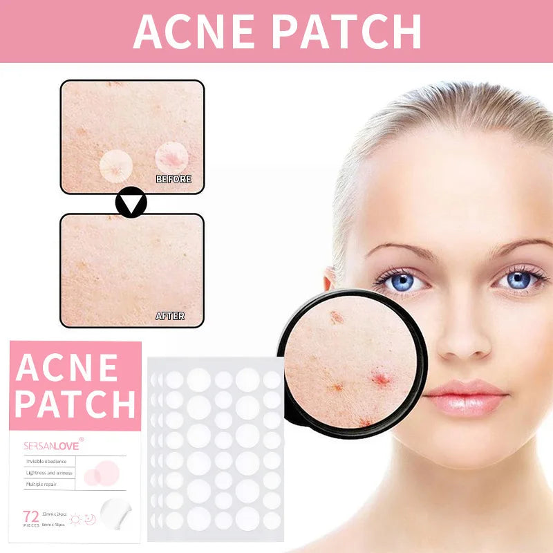 Acne and Pimple Removal And Spots Repair Stickers.