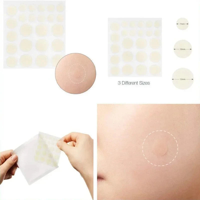 Facial Patches for Treatment of Scar,Acne and Blackheads.