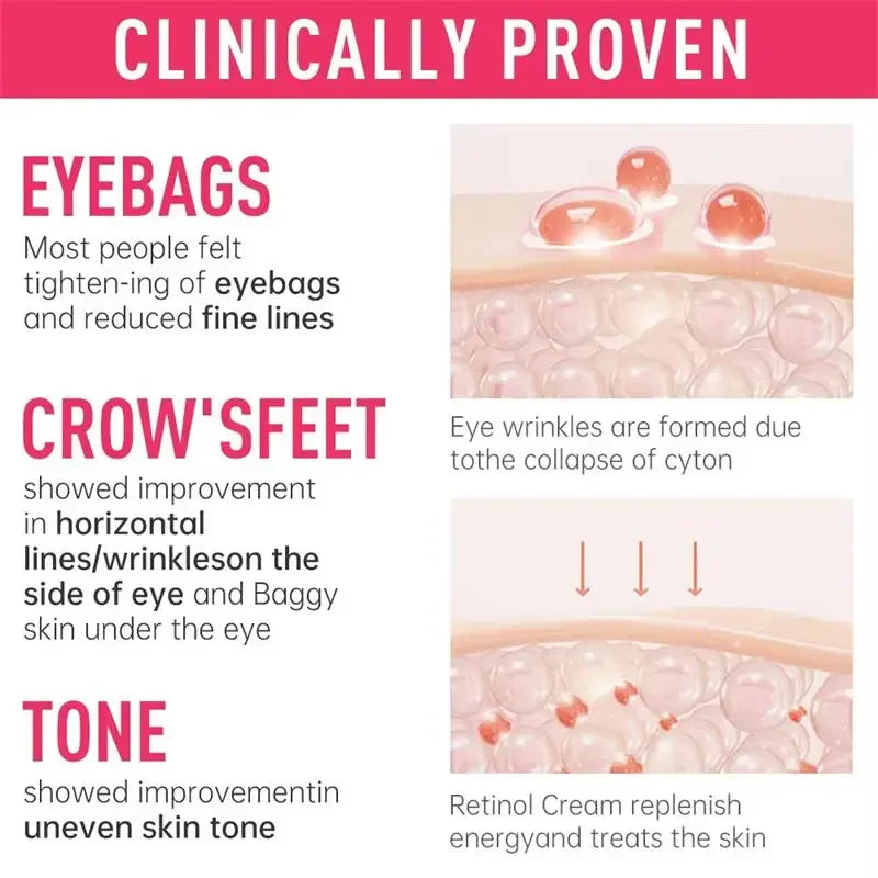 Eye Bag and Dark Circle Removal