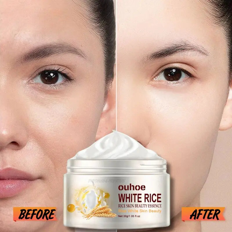 Rice Anti-Wrinkle Acne Moisturizer