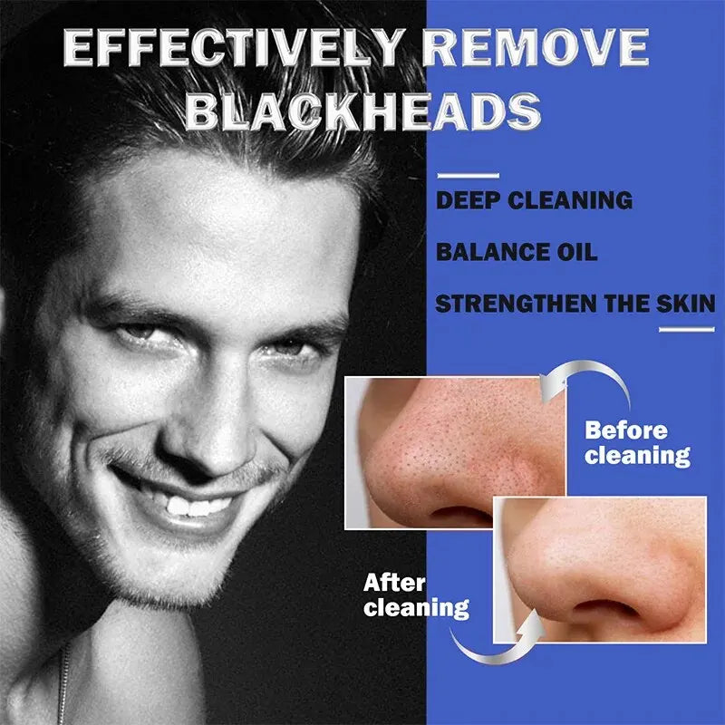 Men’s Nasal Strip for Blackhead Removal