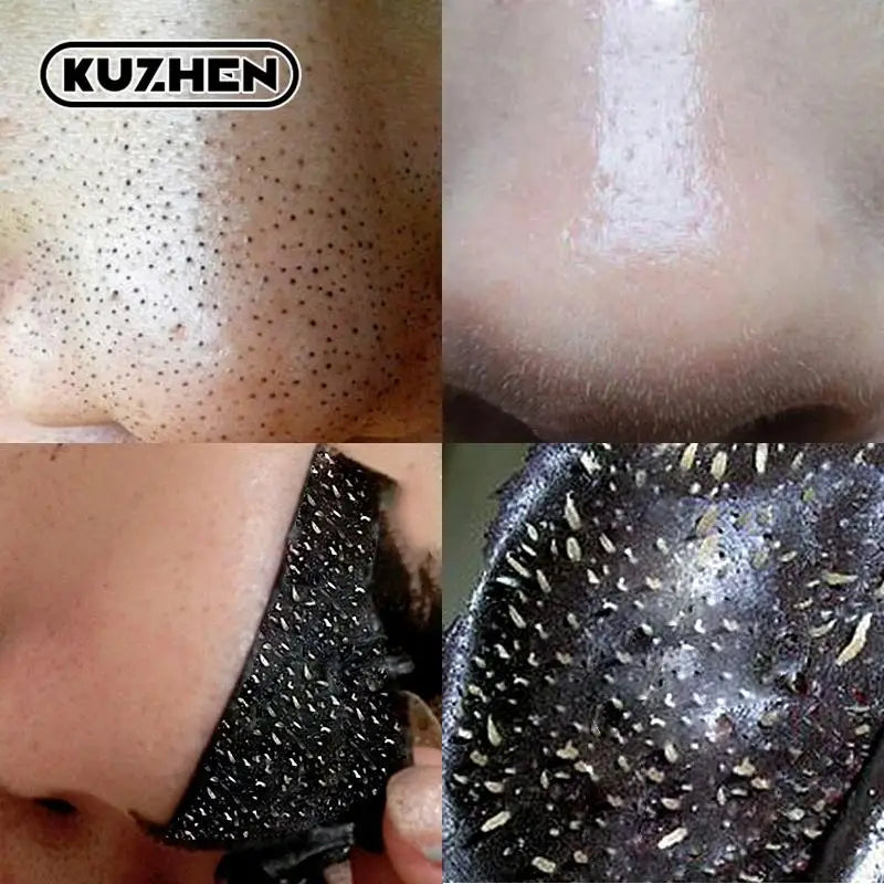 Nose Blackhead Remover Mask