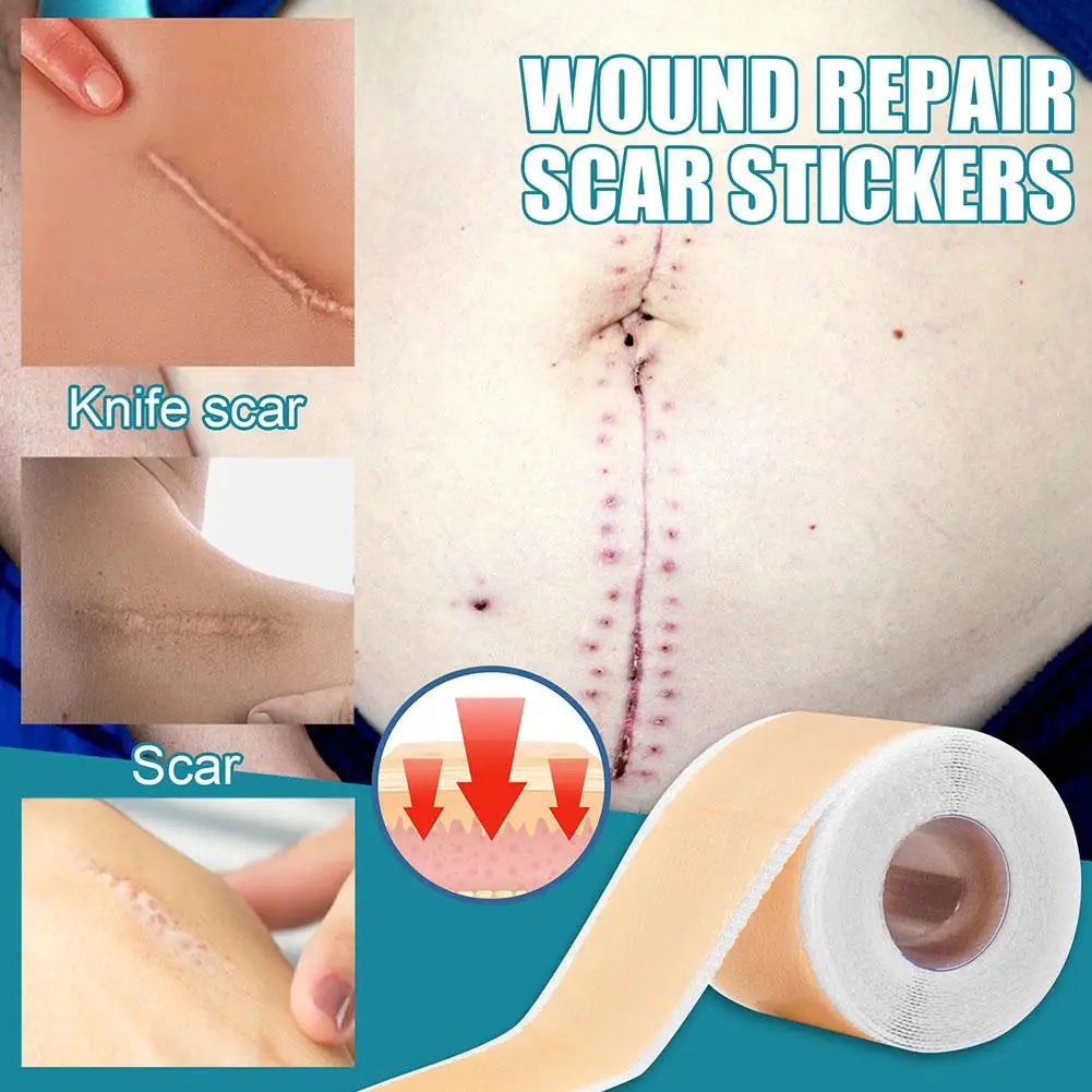 Acne And Burn Scar Sheet Patch Treatment.