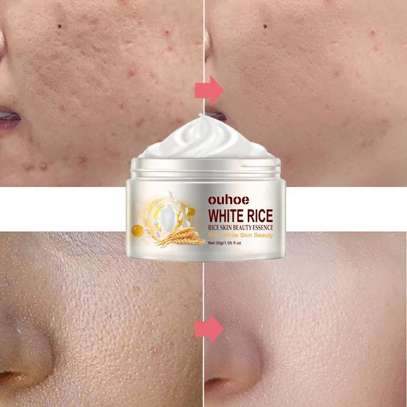 Rice Anti-Wrinkle Acne Moisturizer