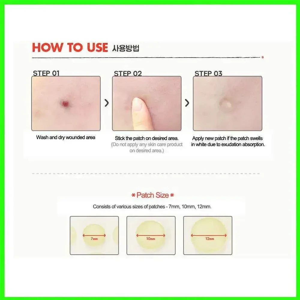 Facial Patches for Treatment of Scar,Acne and Blackheads.