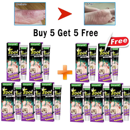 Anti-Foot Fungus Cream - BLAKESTORE-NG