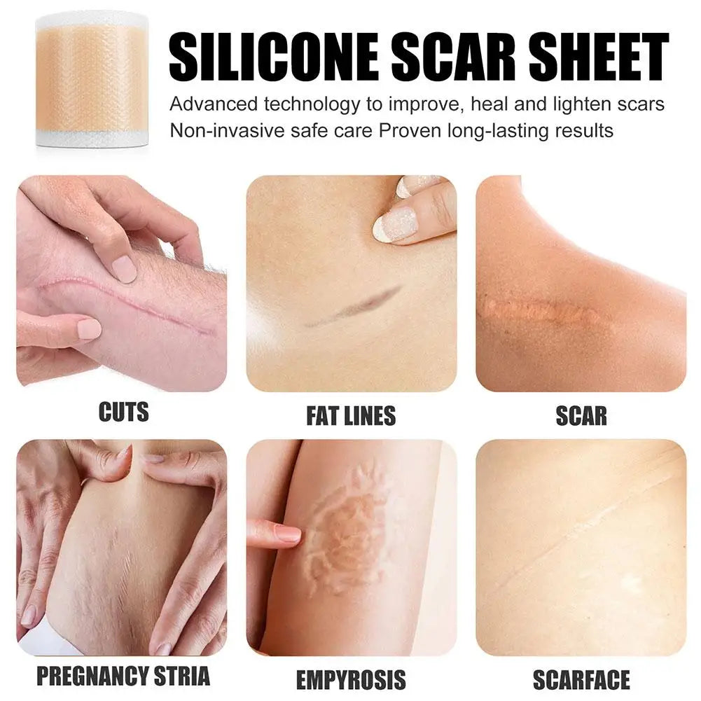 Acne And Burn Scar Sheet Patch Treatment.