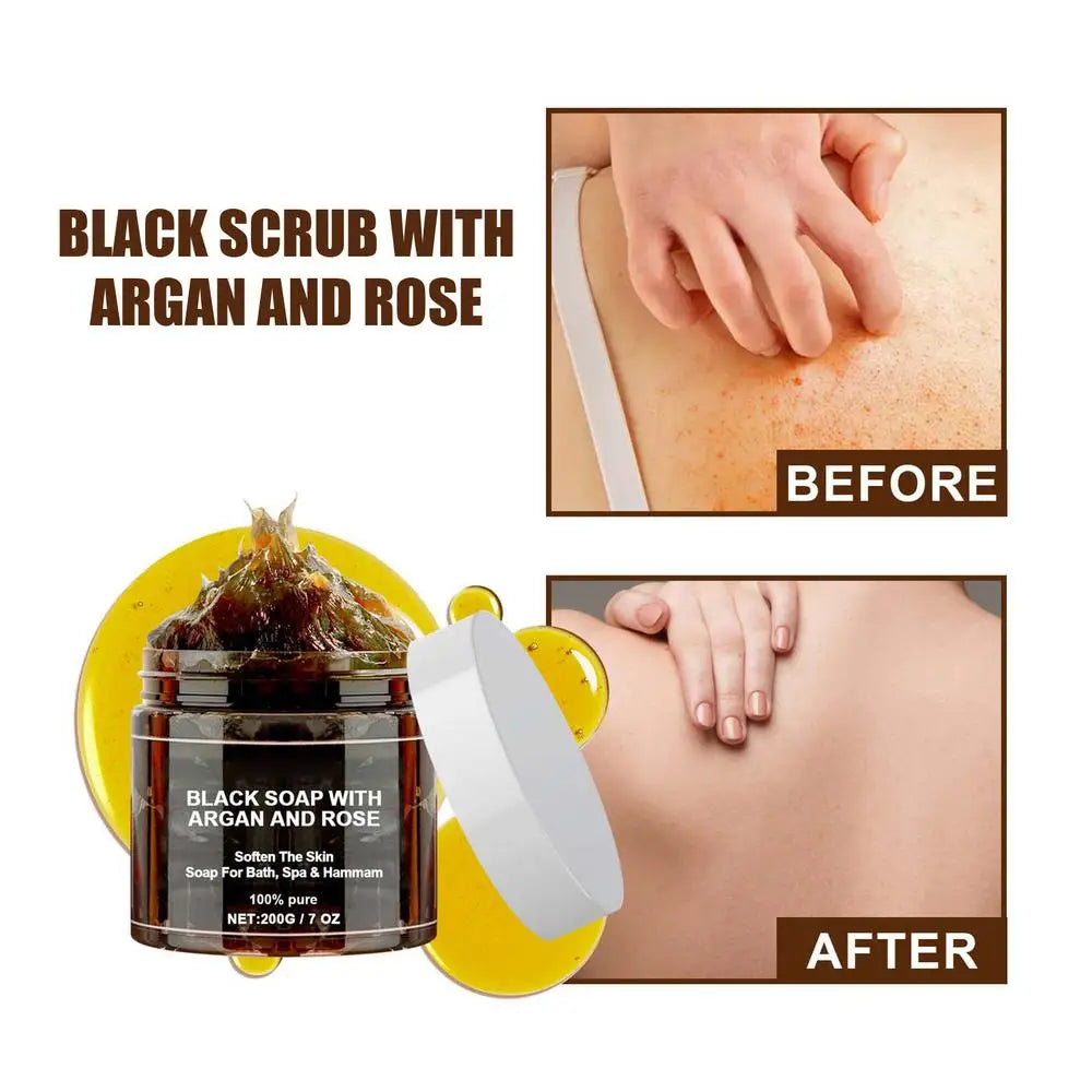 Moroccan Black Body Scrub-Remove Acne.