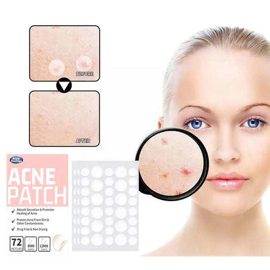 Acne and Pimple Removal And Spots Repair Stickers.